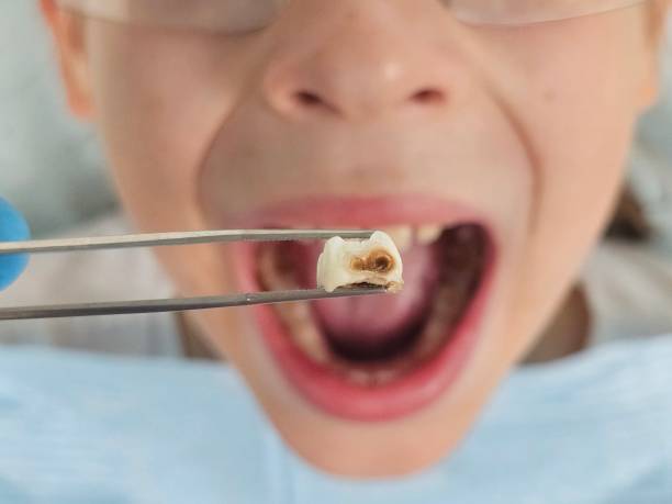 Best Emergency Care for Gum Disease in Dunwoody, GA